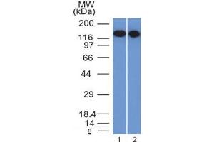 Western blot testing of FFPE human 1) Raji and 2) Ramos cell lysate with CD22 antibody (clone BLCAM/1795). (CD22 Antikörper  (AA 52-178))