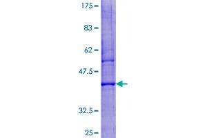 Image no. 1 for Lysozyme-Like 6 (LYZL6) (AA 1-148) protein (GST tag) (ABIN1309964) (LYZL6 Protein (AA 1-148) (GST tag))