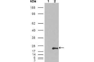 Western Blot showing GSTP1 antibody used against HEK293T cells transfected with the pCMV6-ENTRY control (1) and pCMV6-ENTRY GSTP1 cDNA (2). (GSTP1 Antikörper)
