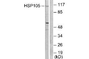 Western blot analysis of extracts from HeLa cells, using HSP105 antibody (#C0231). (HSPH1 Antikörper)