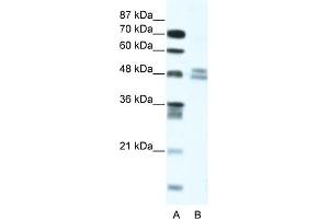 WB Suggested Anti-TRIAntibody Titration:  5. (TRIP13 Antikörper  (N-Term))