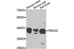 Western blot analysis of extracts of various cells, using FBXO2 antibody. (FBXO2 Antikörper)