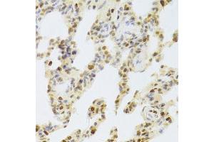 Immunohistochemistry (Paraffin-embedded Sections) (IHC (p)) image for anti-Hepatoma-Derived Growth Factor (HDGF) (AA 1-240) antibody (ABIN6141694)
