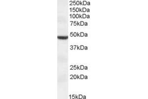 Image no. 1 for anti-Transmembrane Protease, serine 4 (TMPRSS4) (AA 243-255) antibody (ABIN490516) (TMPRSS4 Antikörper  (AA 243-255))