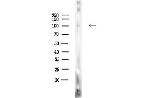 Western blot analysis of lysates from A375 cells(heat-shock,45 min treatment), using Phospho-TLR3 (Tyr858) Antibody at 1/1000 dilution.