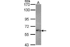 WB Image Sample (30 ug of whole cell lysate) A: Hep G2 , 7. (MTMR9 Antikörper  (C-Term))
