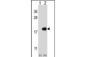 Western blot analysis of FABP2 (arrow) using rabbit polyclonal FABP2 Antibody (N-term) (ABIN656830 and ABIN2846039).