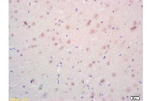 Formalin-fixed and paraffin embedded rat brain labeled with Rabbit Anti phospho-Androgen Receptor(Ser578) Polyclonal Antibody, Unconjugated (ABIN730123) at 1:200 followed by conjugation to the secondary antibody and DAB staining (Androgen Receptor Antikörper  (pSer578))