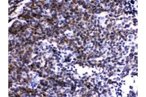 IHC testing of FFPE mouse lymph node with LCK antibody.