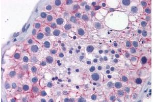 Human Testis: Formalin-Fixed, Paraffin-Embedded (FFPE) (TJP1 Antikörper  (AA 935-984))