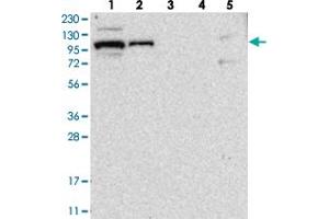 Western blot analysis of Lane 1: RT-4, Lane 2: U-251 MG, Lane 3: Human Plasma, Lane 4: Liver, Lane 5: Tonsil with BICD2 polyclonal antibody . (BICD2 Antikörper)