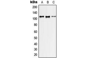 Western blot analysis of GEF H1 expression in HeLa (A), NIH3T3 (B), H9C2 (C) whole cell lysates. (ARHGEF2 Antikörper  (Center))