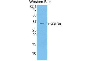 Detection of Recombinant COL1a1, Mouse using Polyclonal Antibody to Collagen Type I Alpha 1 (COL1a1) (COL1A1 Antikörper  (AA 1225-1453))