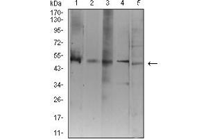Western Blotting (WB) image for anti-ATG3 Autophagy Related 3 (ATG3) (AA 1-100) antibody (ABIN5611290)