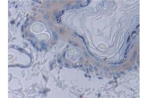 Immunohistochemistry (IHC) image for anti-Signal Transducing Adaptor Molecule (SH3 Domain and ITAM Motif) 1 (STAM) (AA 199-466) antibody (ABIN7443425)