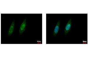 ICC/IF Image VCP antibody detects VCP protein at cytoplasm and nucleus by immunofluorescent analysis. (VCP Antikörper  (C-Term))