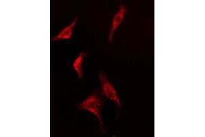 ABIN6278569 staining  HepG2 cells by IF/ICC. (FAF1 Antikörper  (C-Term))