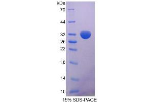 Image no. 1 for Methylthioadenosine phosphorylase (MTAP) (AA 6-275) protein (His tag) (ABIN4990497)