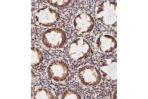 Immunohistochemistry (Paraffin-embedded Sections) (IHC (p)) image for anti-Prohibitin 2 (PHB2) (AA 225-255) antibody (ABIN391413)