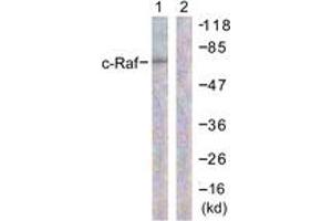 Western blot analysis of extracts from 293 cells, treated with PMA 125ng/ml 30' , using C-RAF (Ab-296) Antibody. (RAF1 Antikörper  (AA 271-320))