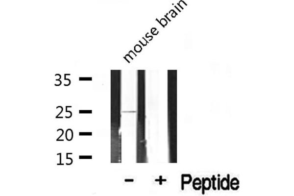 Claudin 2 Antikörper  (C-Term)