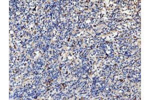 IHC analysis of PLD3 using anti-PLD3 antibody (ABIN7599439). (PLD3 Antikörper  (AA 1-490))