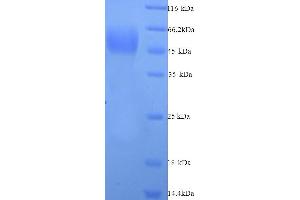 SDS-PAGE (SDS) image for Myeloproliferative Leukemia Virus Oncogene (MPL) (AA 26-491), (Extracellular) protein (His tag) (ABIN5713662) (MPL Protein (AA 26-491, Extracellular) (His tag))
