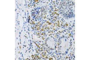 Immunohistochemistry of paraffin-embedded mouse stomach using SMARCE1 Antibody (ABIN5973097) at dilution of 1/200 (40x lens). (SMARCE1 Antikörper)