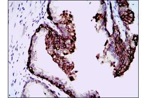 Immunohistochemistry (IHC) image for anti-Hyaluronan Synthase 3 (HAS3) antibody (ABIN1845757) (HAS3 Antikörper)