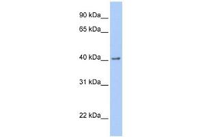 WB Suggested Anti-GFRA2 Antibody Titration: 0. (GFRA2 Antikörper  (C-Term))