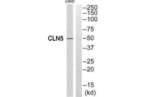 Western blot analysis of extracts from LOVO cells, using CLN5 antibody. (CLN5 Antikörper  (Internal Region))