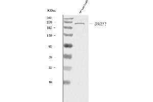 Western blot analysis of Dnmt1 using anti-Dnmt1 antibody (ABIN7601924).