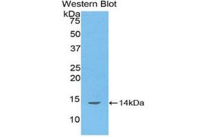 Western blot analysis of the recombinant protein. (DDO Antikörper  (AA 117-199))