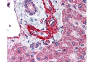 Immunohistochemistry (IHC) image for anti-Angiotensinogen (serpin Peptidase Inhibitor, Clade A, Member 8) (AGT) (Internal Region) antibody (ABIN1048321)