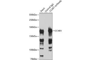 Immunoprecipitation analysis of 200 μg extracts of HeLa cells using 3 μg CC antibody (ABIN6129224, ABIN6138030, ABIN6138032 and ABIN6217655). (CCAR1 Antikörper  (AA 1-200))