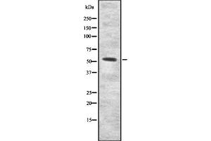 Western blot analysis of INAR2 expression in HEK293 cells ,The lane on the left is treated with the antigen-specific peptide. (IFNAR2 Antikörper  (C-Term))