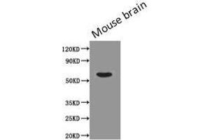 Western Blotting (WB) image for anti-Podocalyxin-Like (PODXL) antibody (ABIN7163728)
