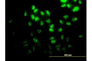 Immunofluorescence of monoclonal antibody to DPH2 on HeLa cell. (DPH2 Antikörper  (AA 125-235))