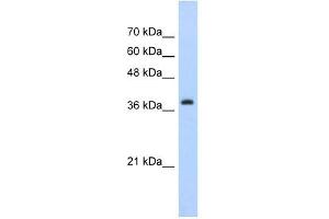 Western Blot showing CBX6 antibody used at a concentration of 1-2 ug/ml to detect its target protein. (CBX6 Antikörper  (C-Term))