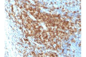 Formalin-fixed, paraffin-embedded human Tonsil stained with CD43 Rabbit Recombinant Monoclonal Antibody (SPN/2049R).