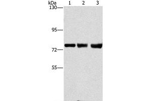 Western Blot analysis of MCF7, hela and 293T cell using GGCX Polyclonal Antibody at dilution of 1:400