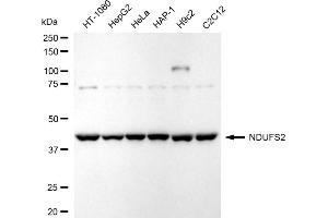 Western blotting analysis using NDUFS2 antibody (ABIN7799556).