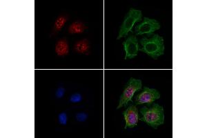 ABIN7094787 and ABIN7098838 staining HepG2 cells by IF/ICC. (DCP2 Antikörper  (Internal Region))