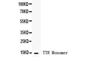 Anti- Prealbumin Picoband antibody, Western blottingAll lanes: Anti Prealbumin  at 0. (TTR Antikörper  (AA 21-147))