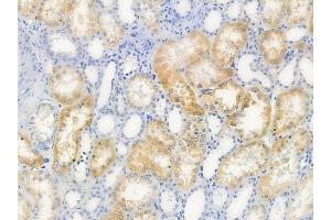 ABIN6259520 and ABIN6273985 at 1/100 staining human normal kidney tissue by IHC-P.