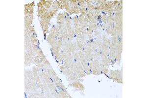 Immunohistochemistry of paraffin-embedded mouse heart using RAB24 antibody at dilution of 1:100 (x40 lens). (RAB24 Antikörper)