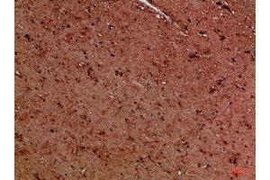 Immunohistochemical analysis of paraffin-embedded Human-brain, antibody was diluted at 1:100 (EYA1 Antikörper)