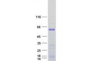 Western Blotting (WB) image for Early B-Cell Factor 3 (EBF3) protein (Myc-DYKDDDDK Tag) (ABIN2719907)