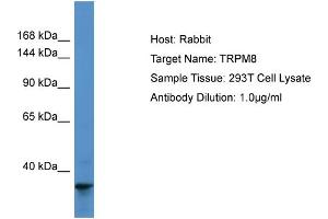 Host: Rabbit Target Name: TRPM8 Sample Type: 293T Whole Cell lysates Antibody Dilution: 1.