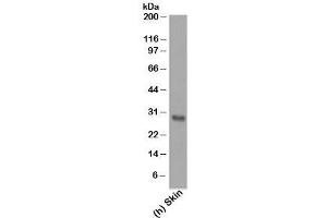 Western blot testing of human samples using Bcl-2 antibody (124). (Bcl-2 Antikörper  (AA 41-54))